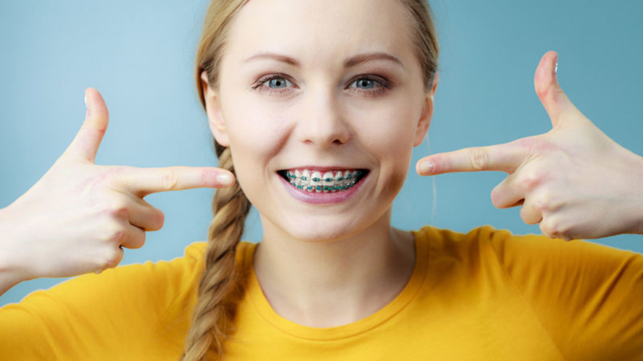 what is the best color for braces quiz